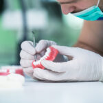 Dentition des seniors : comment fixer la prothèse ?